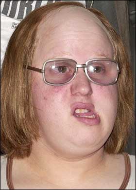 what skiiers look like