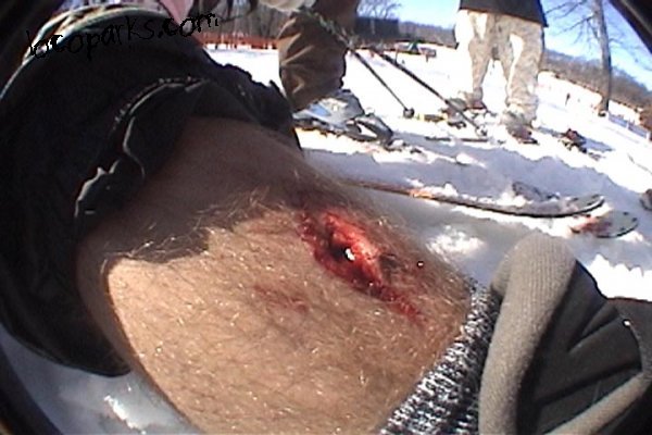 When 7's go wrong...