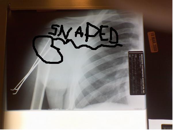X-rays 2