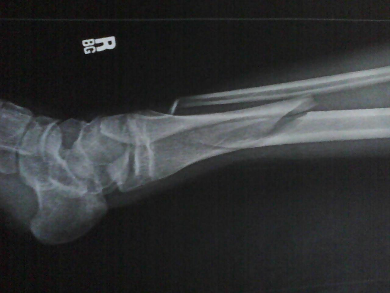 X Rays