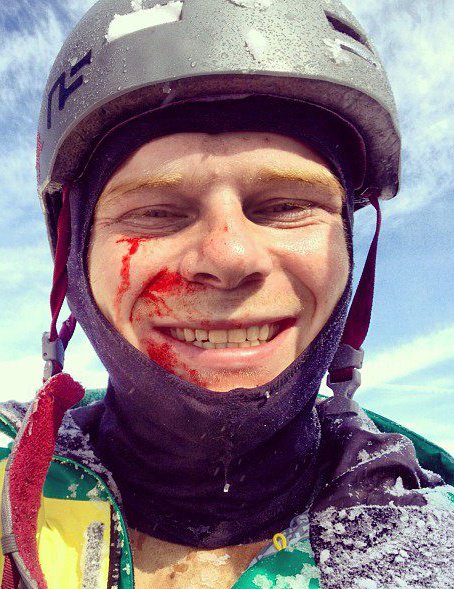 Ya win some ya lose some